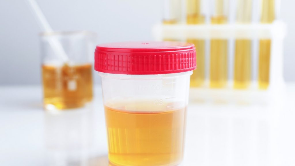 cocaine saliva tests detect recent use better than urine tests